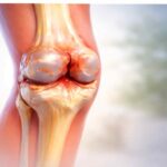 best Osteoarthritis Treatment Doctors In Lucknow