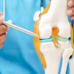 Joint Replacement surgeon in Lucknow