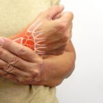 arthritis